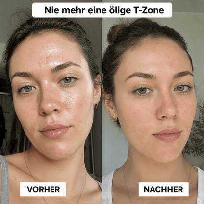 ECHANTÉ TIMIFLY™ Blotting Paper für ölige Haut und T-Zone